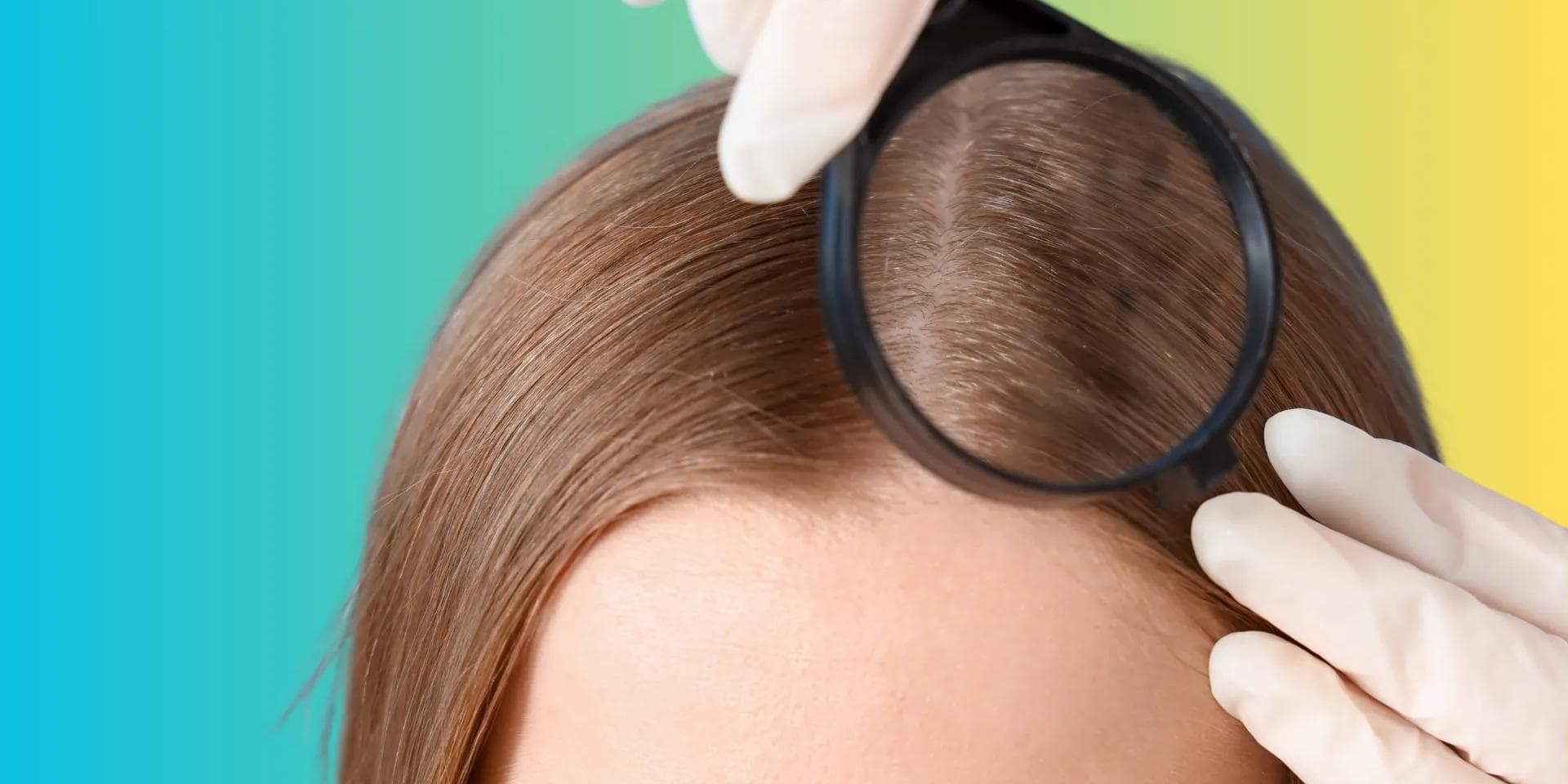 Cover Image for How to Determine Scalp Type